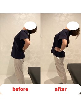 ナオル整体 福岡香椎院(NAORU整体)/40代女性施術事例【腰の痛み】