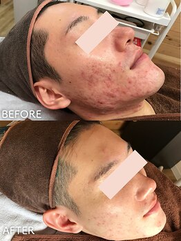 ビアンカ/お客様のお声