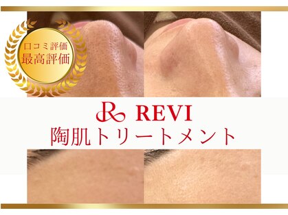 ルナージュ(LUNARJE)の写真