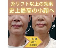目元 口元のたるみ 眉間シワ改善専門サロン