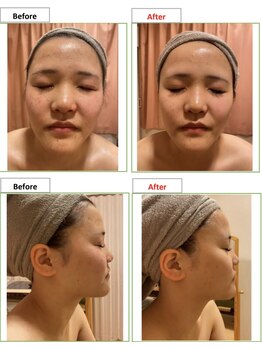 エステティック レイビス 銀座店(RAYVIS)/