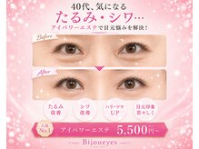 ビジューアイズ(Bijou eyes)の雰囲気（神奈川県当店のみ話題たるみ改善！目元悩み集中特化エステ）