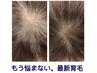 幹細胞培養液で細く少なくなった毛を改善