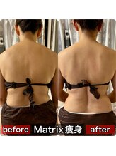 サロンデイジー(Salon Daisy)/Matrix痩身★施術一回