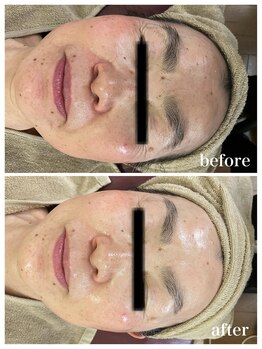 ジャスミン(Jasmin)/エステティック×シェービング