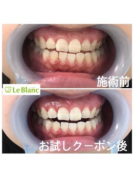 ルブラン 奈良店(Le Blanc)/1日集中プラン!!