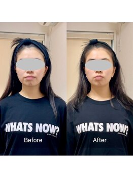 ククナ(Kukuna)/小顔整顔