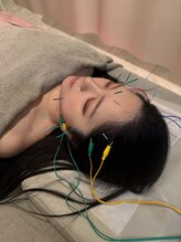 いこい鍼灸院 整骨院 小倉院/美容鍼