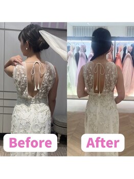 ボディキュア ブライダル美容整体 大阪梅田/ー6kgでみんなに褒められた！