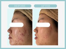 アコガレコガオ 盛岡店/