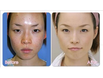 順蘭堂/小顔・肌ケア