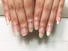 リリーヘブン(LILY HEAVEN)/次の画像が施術後の写真です！