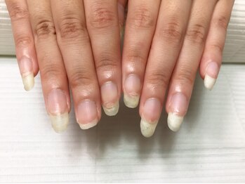 リリーヘブン(LILY HEAVEN)/次の画像が施術後の写真です!