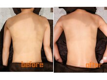 イチ(ichi)/内臓ケア＋背中オイル一回の変化