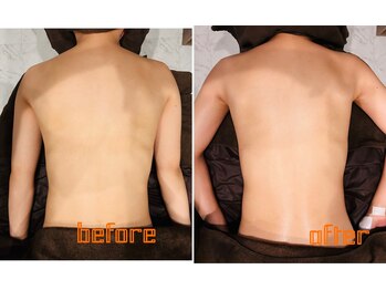 イチ(ichi)/内臓ケア+背中オイル一回の変化