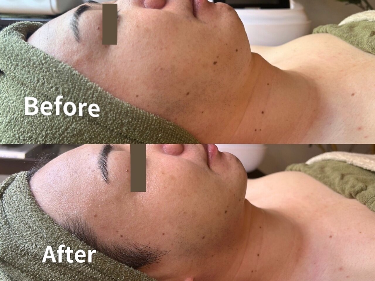 肌質改善エステサロン♡ シゼン 恵比寿店(S1ZEN+)｜ホットペッパービューティー