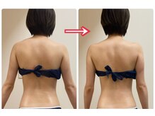 アクア(AQUA)/猫背矯正＆ハイパーナイフ痩身