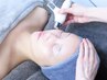 【導入×フェイスリフト】エレクトロポレーション×ラジオ波フェイスリフト