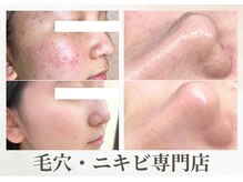 ムク(Muqu.)