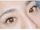 ユイ(YUI)の写真