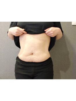 サイズダウンを目指したい