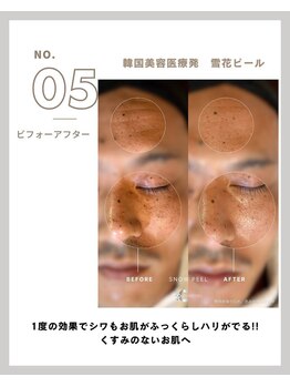 ラ メール(La mer)/★雪花ピール BeforeAfter★