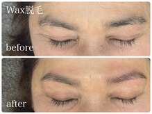 フルミー(fulme.)/WAX脱毛before＆after