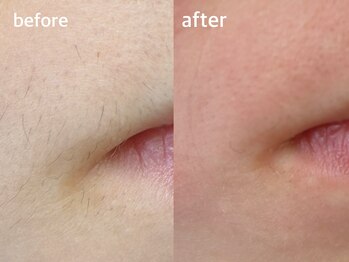 メイクマジック(Makemagic)/お口周りのうぶ毛