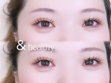 ロエン 北岡崎(ROEN)/&ヘルシー