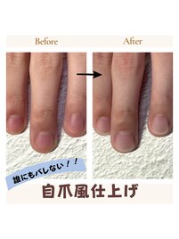 深爪矯正自爪風仕上げ