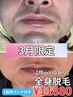 【3月男性限定】嬉しい1箇所パック付き♪全身脱毛+(顔orVIO)