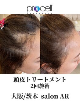 サロン アール(salon AR)/【プロセルセラピーズ】