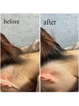 クレセント(crescent)/ツヤ肌脱毛