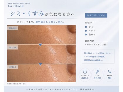 ラ クレール ビューティーサロン(LA CLAIR)の写真