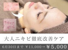 フェイシャル専門店 エピア 掛川店(Epia)