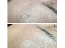 レミューズ(LES MUSES)/ツヤとハリが出て滑らかな肌に