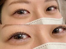 エムアイラッシュ(EMU.eyelash)