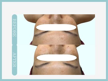 アコガレコガオ 盛岡店/