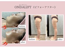 サロンドココ(Salon de COCO)の雰囲気（【オンダリフト】小顔人気No1♪小顔/リフトアップ/二重顎）