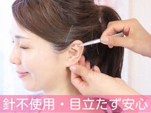 施術は短時間で完了します。