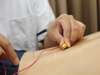 きむら整骨院 鍼灸院の写真/NEW OPEN◆仕事終わりOK◎腰痛/肩こり/眼精疲労…最新の機械と国家資格の技術で根本原因にアプローチ