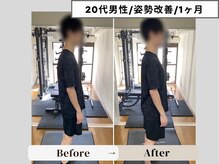 グリター(GlitteR)/施術後の姿勢改善