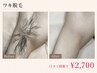【男性口コミ限定】ワキ脱毛￥2,700◎口コミ投稿限定