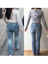 アユアランリンク 札幌店/20代前半/約5ヵ月半/-12kg