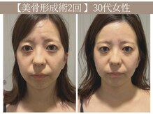 ドクターボディ 恵比寿店(Dr.Body)の雰囲気（【頬のたるみ/顔の長さ/おでこのシワ改善】卵顔に 小顔/恵比寿）