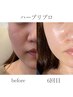 人気No.1【肌育◎/艶肌/小顔】静岡希少リプロハーブ◎肌診断付き¥30,000