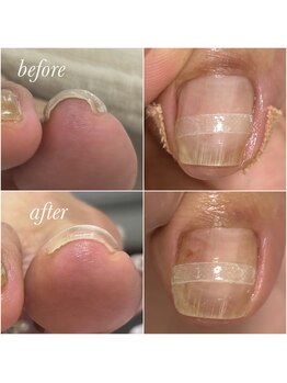 リゼラアンドコー 布施店/