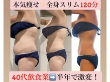 マール(Mar)/ビフォーアフター　全身痩身