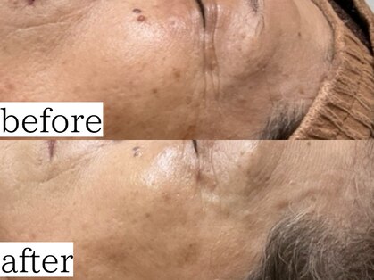 アンドナップ(nap)の写真