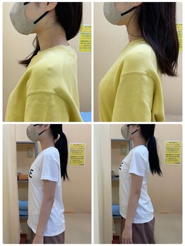 田井整体 整骨院/田井式筋膜リリース整体